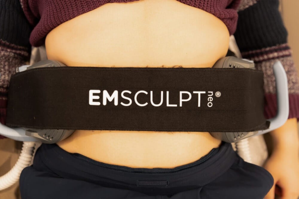 EMSCULPT Neo